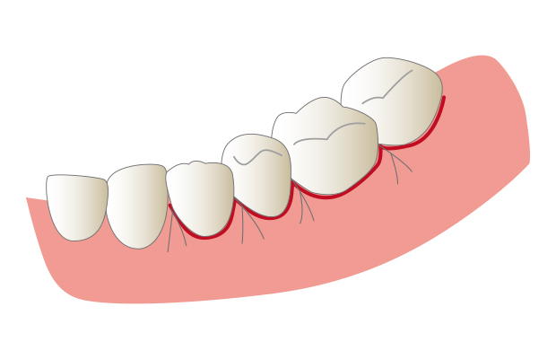 7.歯周外科手術